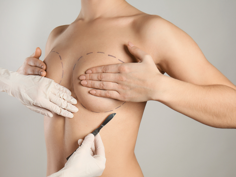 Breast Augmentation Plastic Surgery Malaysia No.1 Breast