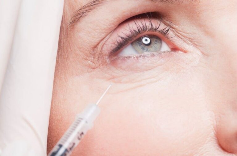 eyebag removal