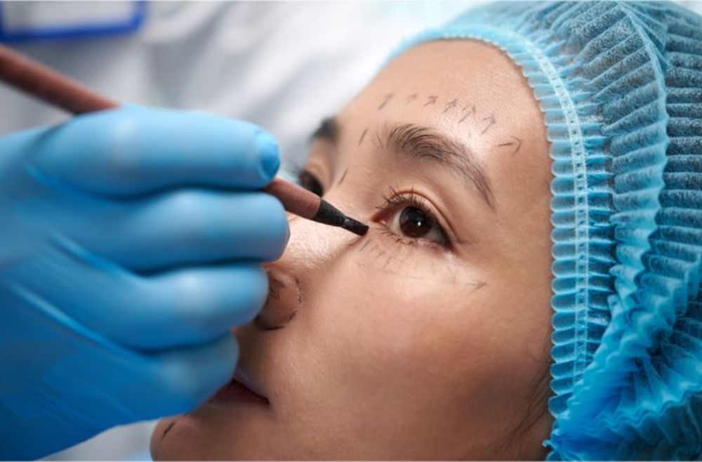 eyebag removal surgery