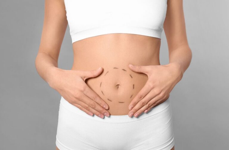 Tummy tuck Malaysia