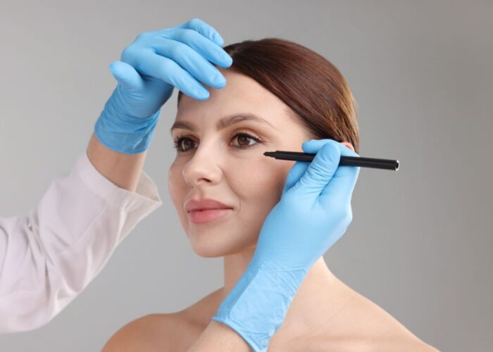 Eyebag Removal vs Eye Creams: Which Option Works Better?