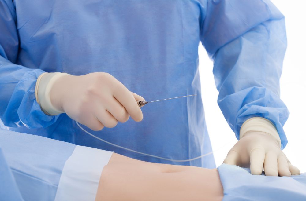 Cosmetic surgery Malaysia: Liposuction