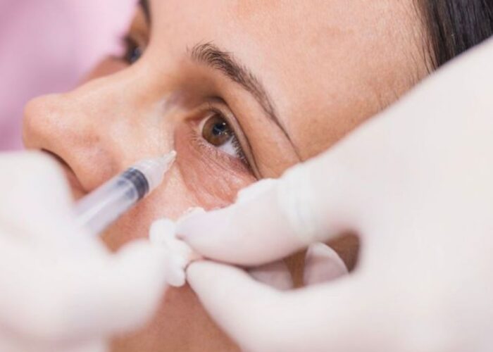 Eyebag Surgery: Understanding Different Treatment Approaches